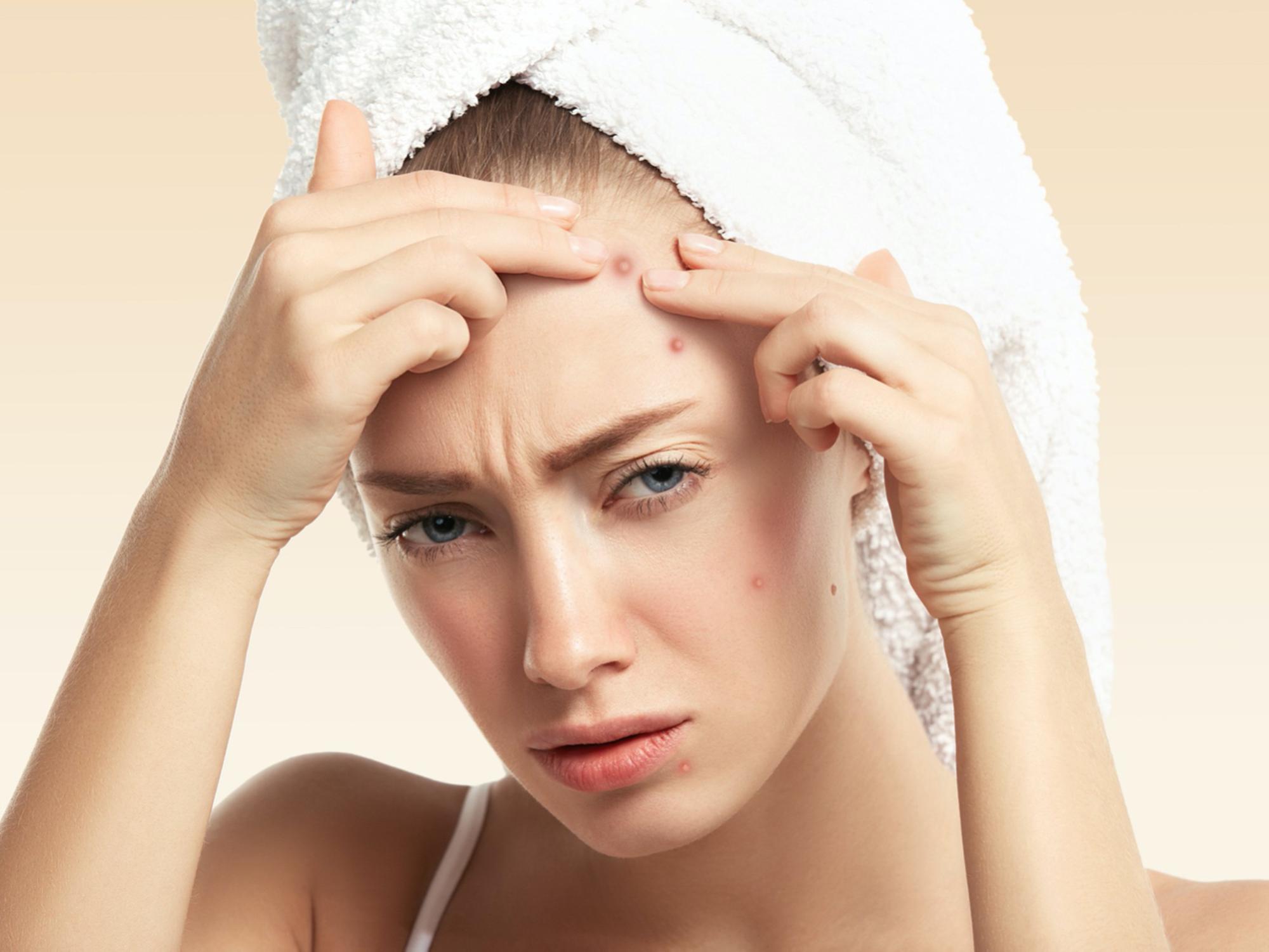 一文詳解頭瘡成因與症狀，頭瘡護理不善會造成脫髮